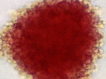 赤血球をつくる（改訂版）－エリスロポエチンを追って－